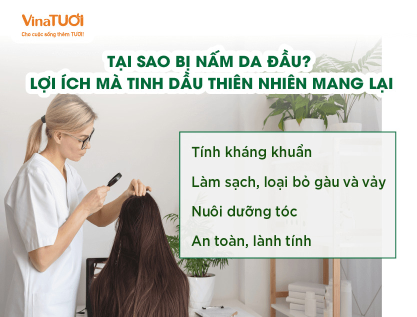 Tại sao bị nấm da đầu? Lợi ích mà tinh dầu thiên nhiên mang lại