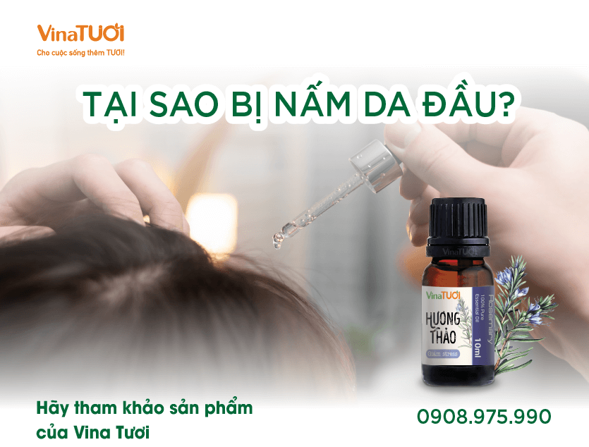 Tại sao bị nấm da đầu? Hãy tham khảo sản phẩm của Vina Tươi